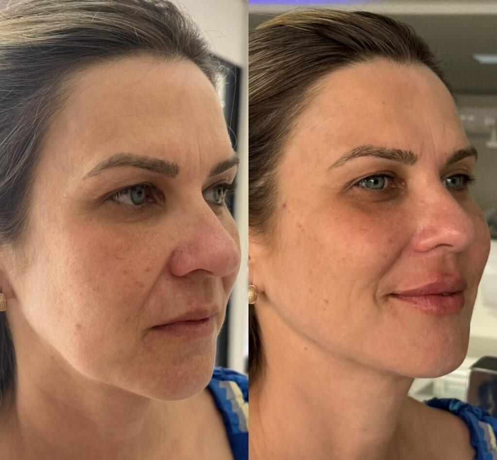 resultados dra aline maia 1