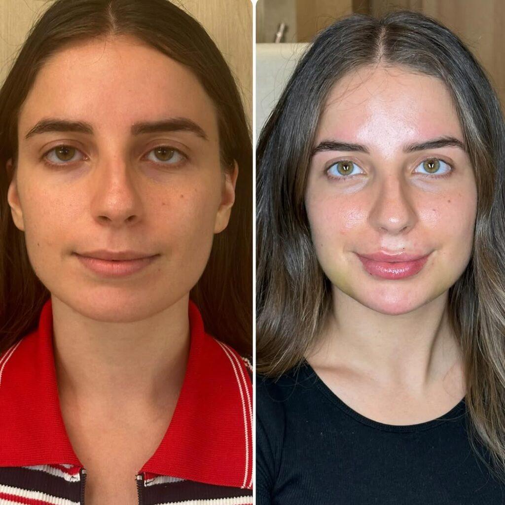 resultados dra aline maia 4