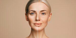 uanto custa uma harmonizacao facial resultado natural.jpg