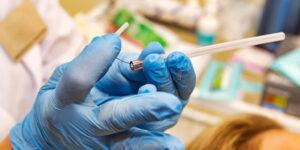 fio de sustentação facial utilizado em procedimento estético para rejuvenescimento e duração dos resultados