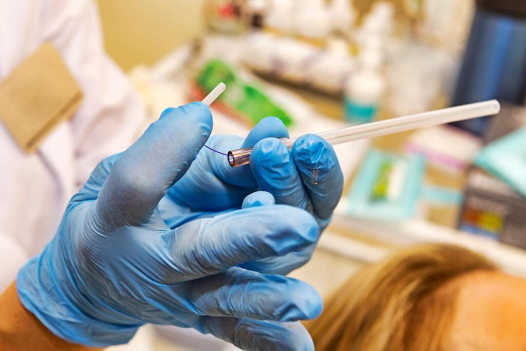 fio de sustentação facial utilizado em procedimento estético para rejuvenescimento e duração dos resultados