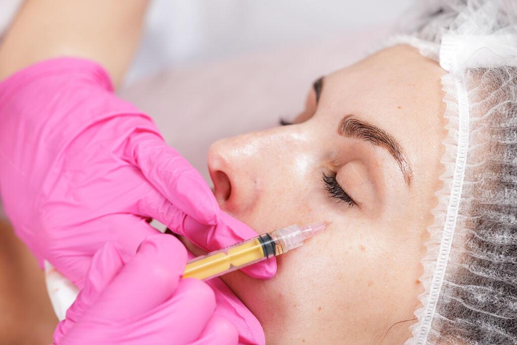 Tratamento estético para olheiras com aplicação de ácido hialurônico na região abaixo dos olhos