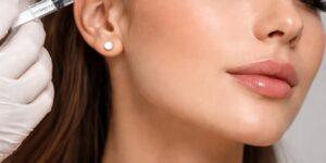 preenchimento temporal estetico rosto feminino.jpg